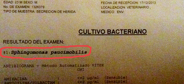 Que limpiar el organismo a atopicheskom la dermatitis